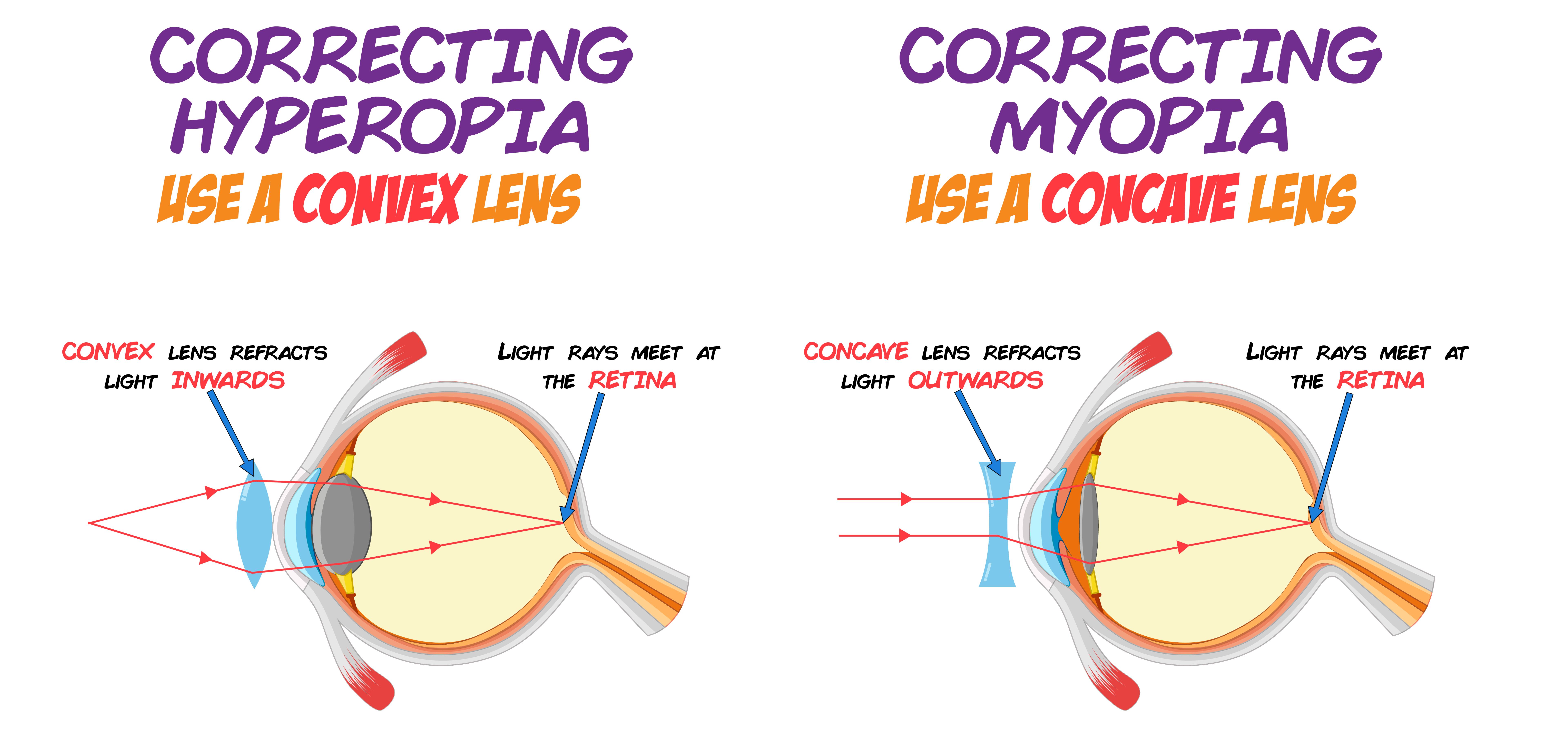 Correcting Vision