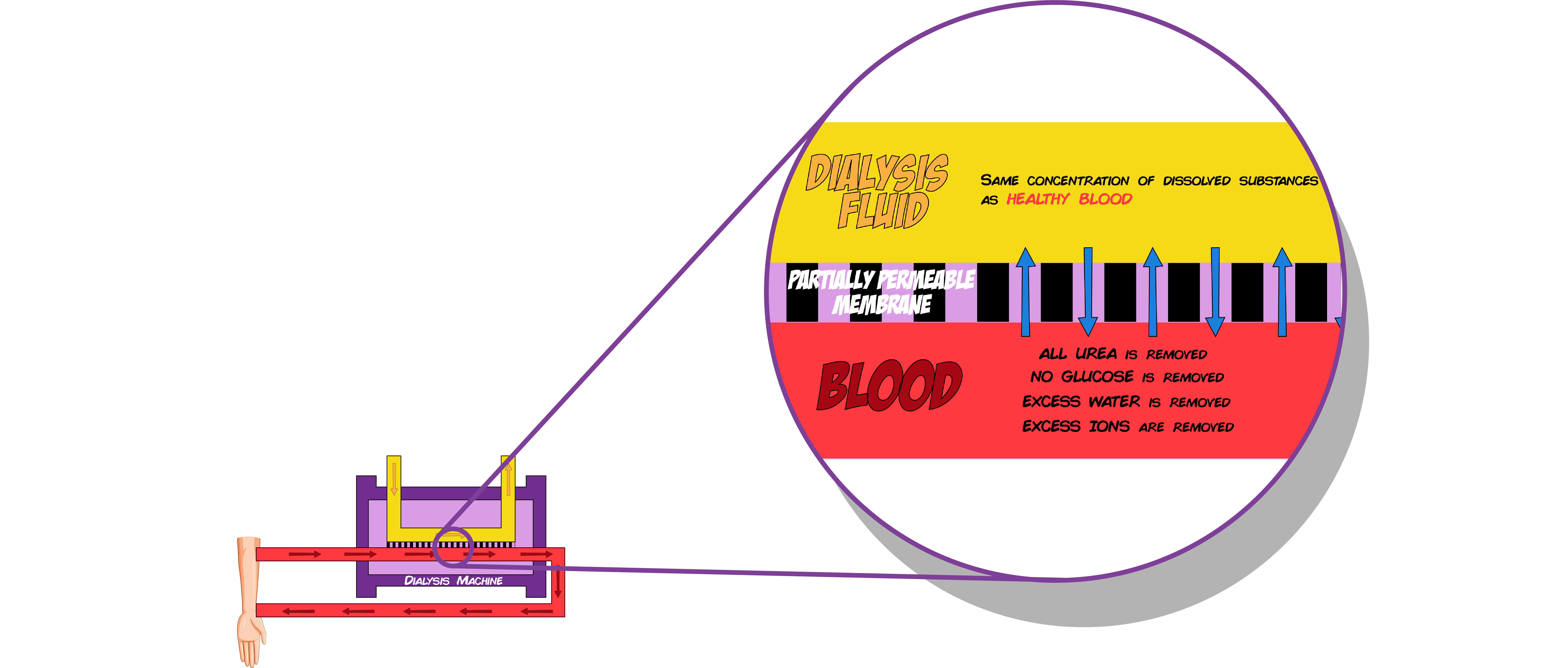 Dialysis Fluid