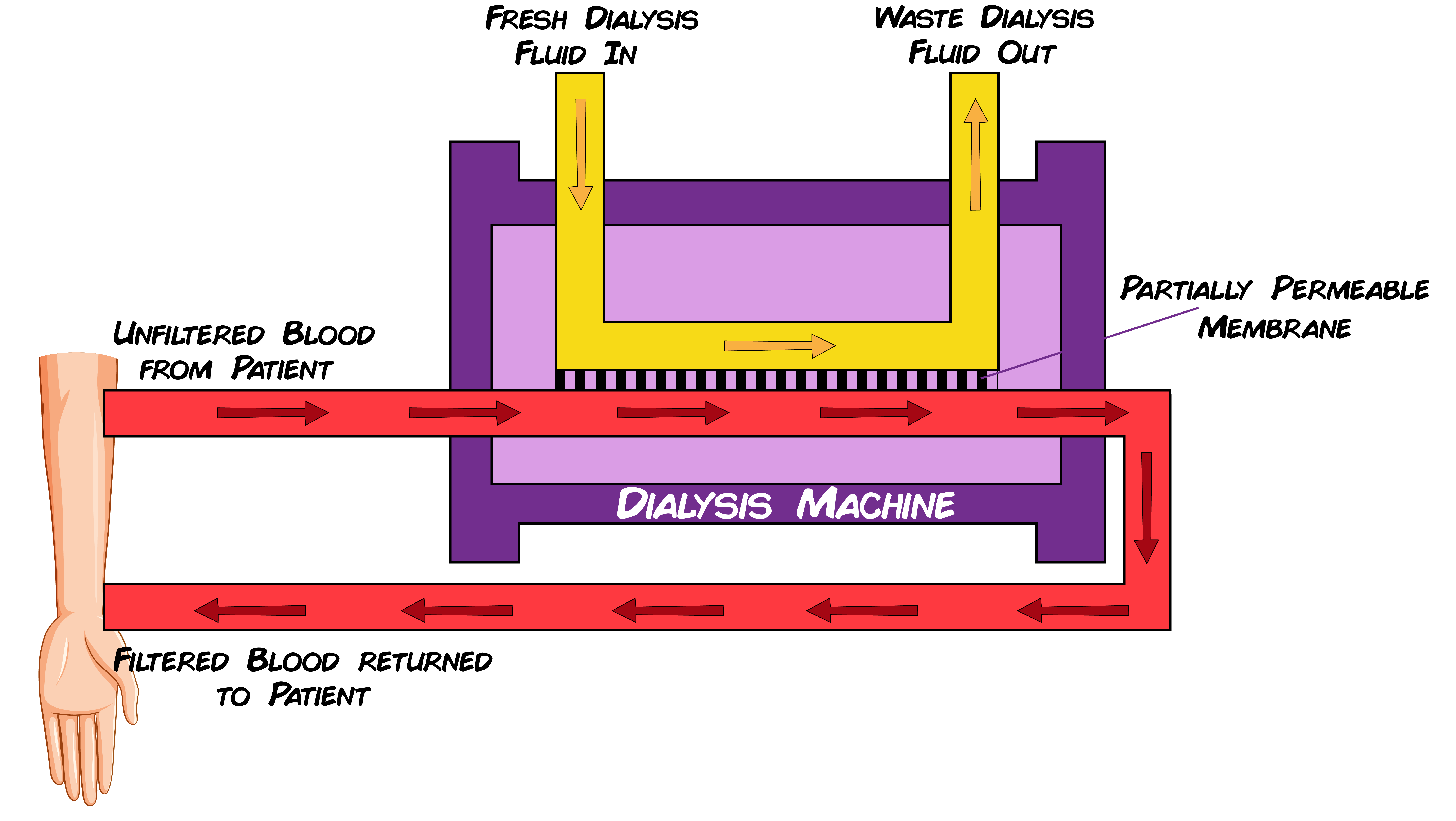 Dialysis Machine
