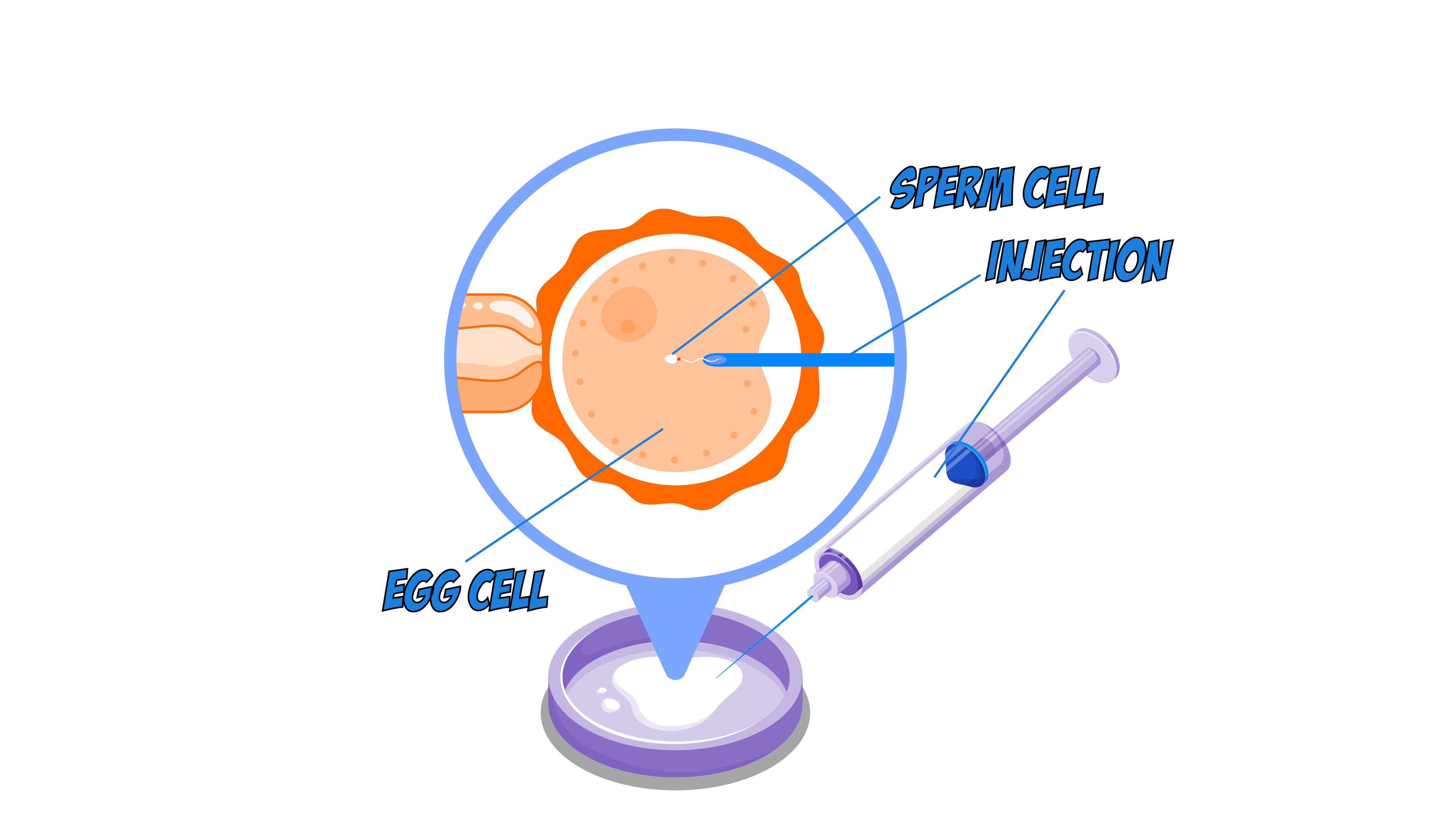 IVF Injection